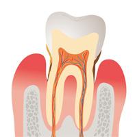 歯周病は早期発見が大切